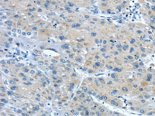 Anti-TNIP1