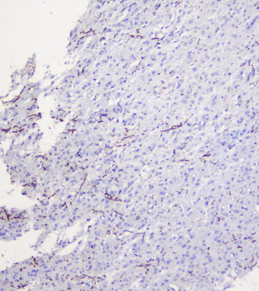 Anti-MOG / Myelin oligodendrocyte glycoprotein