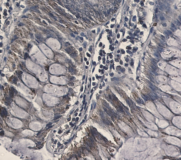 Anti-FDX1 / Ferredoxin