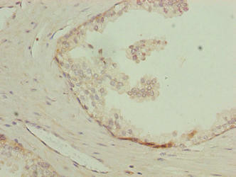 Anti-LYSMD1