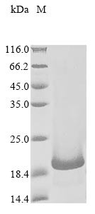 B melanoma antigen 2 (BAGE2), human, recombinant