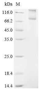Follicle-stimulating hormone receptor (Fshr), rat, recombinant
