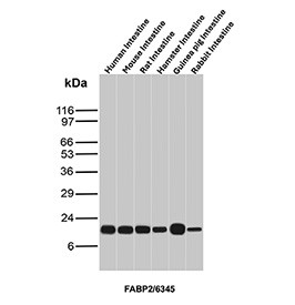 Anti-FABP2 / Intestinal fatty acid-binding protein, clone FABP2/6345