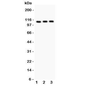 Anti-TRPC5