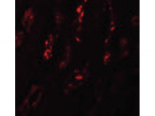 Anti-SCRN1