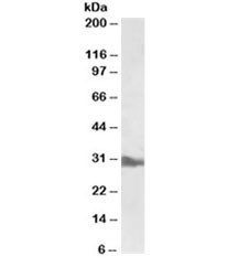 Anti-APOA1