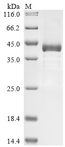 Complement factor I (CFI), partial, human, recombinant