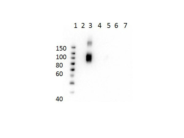 Anti-Hemoglobin beta A-2, clone 21G1.F1.B9.G9.D11