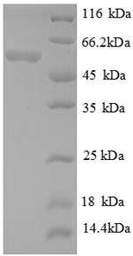 Glutamate decarboxylase alpha (gadA), Escherichia coli, recombinant