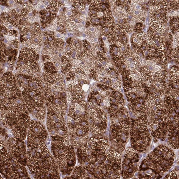 Anti-LIMS1