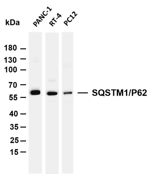 Anti-Recombinant SQSTM1/p62, clone 10A5