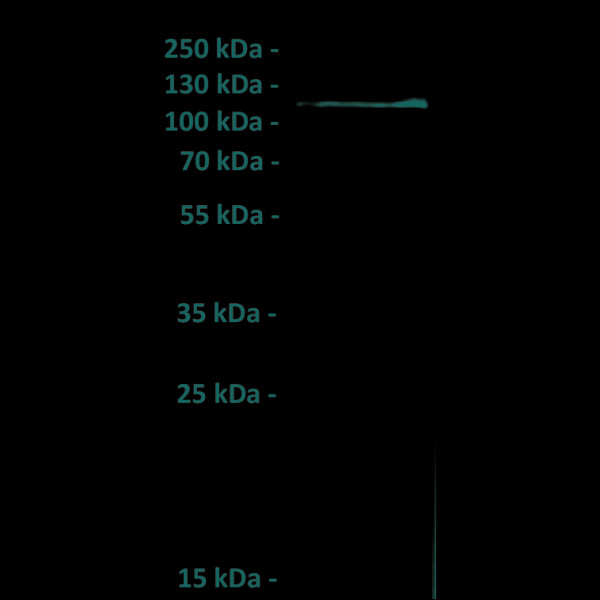 Anti-ROR1 antibody(151A5), IgG1 Chimeric mAb