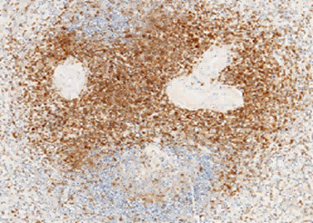 Anti-CD3d/CD3 delta Monoclonal Antibody