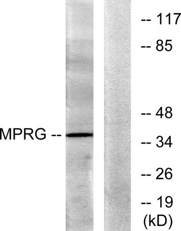 Anti-mPRgamma