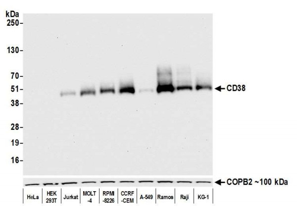 Anti-CD38 Recombinant Monoclonal