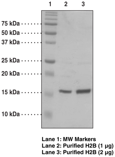 Histone H2B (Xenopus recombinant)