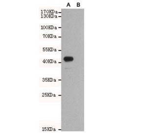 Anti-WNT5B, clone 3D1-F4-E9