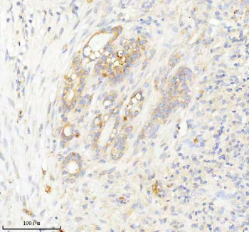 Anti-INTS4 / Integrator complex subunit 4