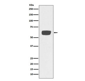 Anti-tPA / Tissue Plasminogen Activator, clone AOAC-16
