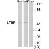 Anti-LTBR