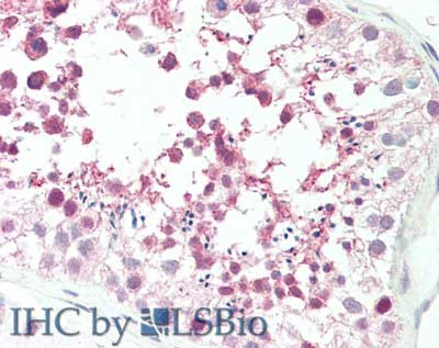 Anti-MLF1 Interacting Protein