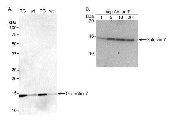 Anti-Galectin-7