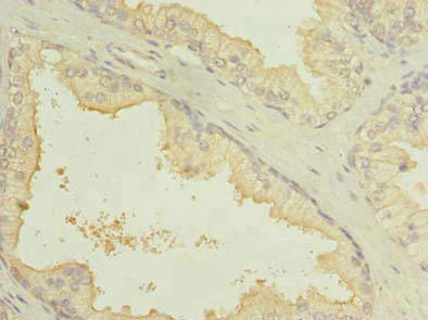 Anti-SLC7A14