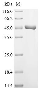 NAD (+) hydrolase SARM1 (Sarm1), partial, mouse, recombinant