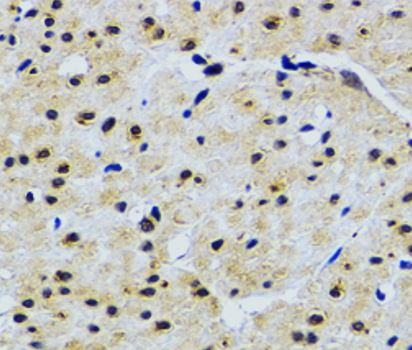 Anti-TRF1
