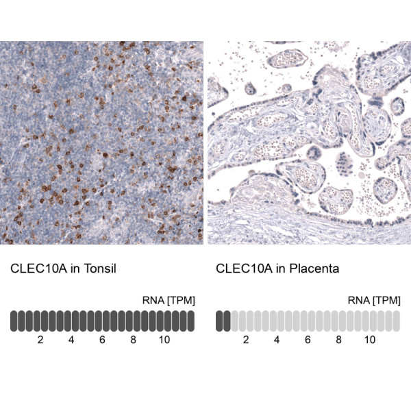 Anti-ABCB5, clone CL15513