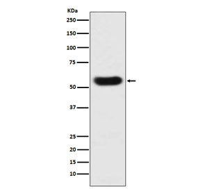 Anti-Antithrombin III, clone ACCA-19