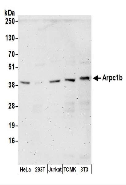 Anti-Arpc1b