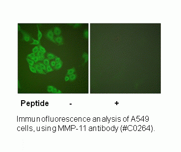 Anti-MMP-11