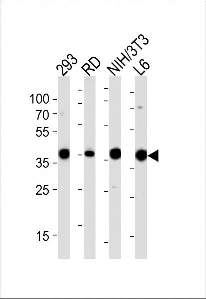 Anti-Aldolase