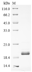 Glucose-6-phosphatase (G6PC), partial, human, recombinant