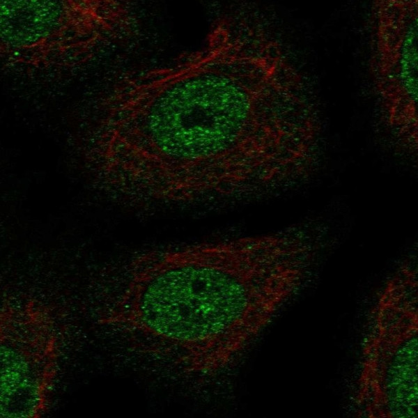 Anti-TSC22D1