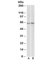 Anti-Alpha-1-Antichymotrypsin