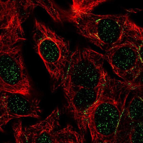 Anti-DPEP1