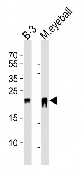 Anti-beta Crystallin