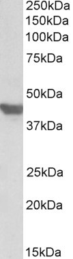 Anti-SLC2A4 / GLUT4, C-terminal