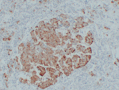 Anti-TSH / Thyroid Stimulating Hormone