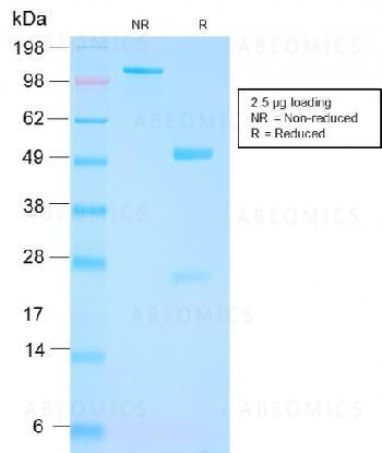 Anti-FOLH1 / PSMA (Prostate Epithelial Marker) Monoclonal Antibody (Clone: FOLH1/3149R)