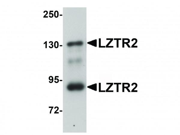 Anti-LZTR2