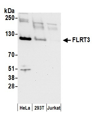 Anti-FLRT3