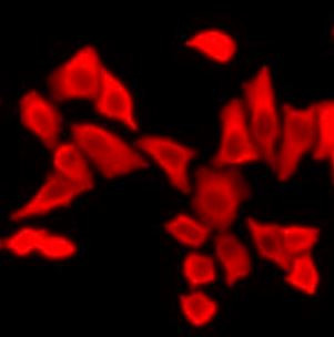Anti-PTH / Parathyroid Hormon