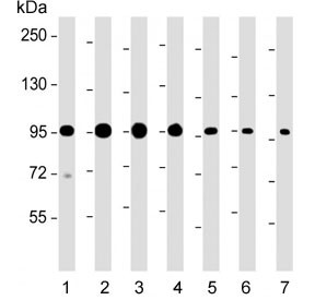 Anti-SCAP / SREBP cleavage-activating protein
