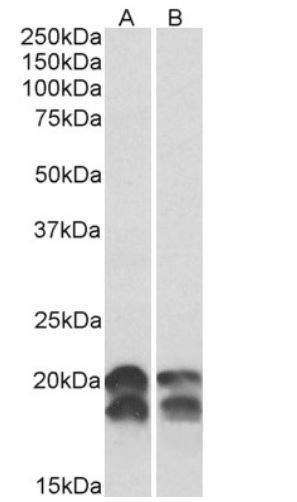 Anti-NM23A