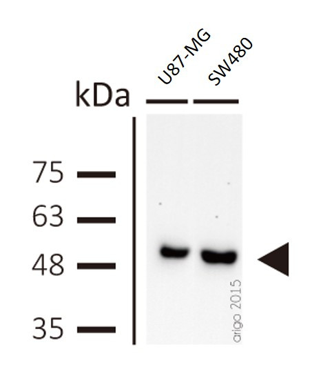Anti-beta Tubulin, clone BT7R