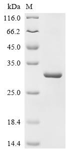G/T mismatch-specific thymine DNA glycosylase (TDG), partial, human, recombinant