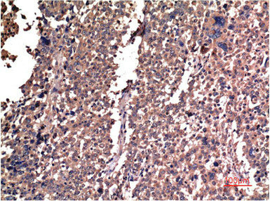 Anti-CCNB1 Monoclonal